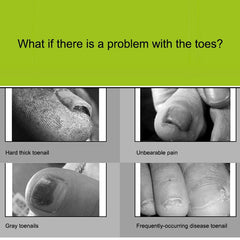 2 in 1 Nail Clipper for Paronychia Stainless Steel Olecranon Nail Nipper & Ingrown Nail Lifter