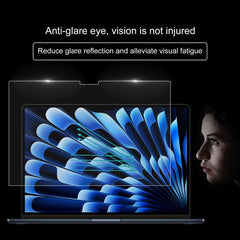 MBC0797_5.jpg@317028076fd7f6f6df06a1be9e195615