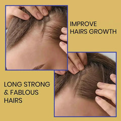 Ammuri Supreme Biotin Shampoo – Daily Hair Care for Thicker-Looking Hair (473ml)