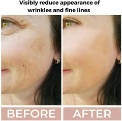 Ammuri Skincare Anti Aging Face Serum - High Volume Retinol 3.5%