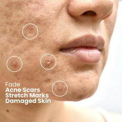 Ammuri Bioactive Snail Repair Serum | Anti-Aging Hydration with 87% Organic Ingredients – 30ml