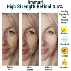 Ammuri Skincare High Strength Retinol Serum 3.5%