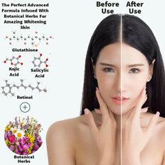 Ammuri Skincare Whitening Lightening Serum for Radiance