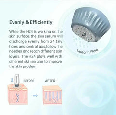 Ammuri Adjustable Derma Roller – 6-in-1 Microneedle Skin Tool for Face, Hair & Body