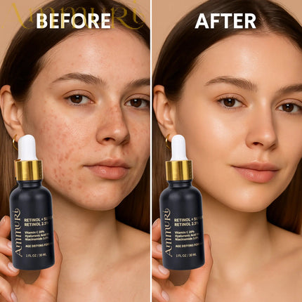 Ammuri 2.5% Retinol Serum - Gentle Anti-Aging Treatment