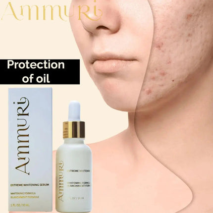 Ammuri Extreme Lightening Serum Premium Whitening Serum 30ml – Kojic Acid + Tranexamic Acid | Dark Spot & Pigmentation Corrector