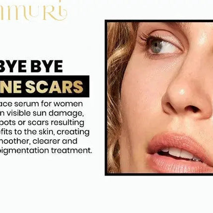 Ammuri Extreme Lightening Serum Premium Whitening Serum 30ml – Kojic Acid + Tranexamic Acid | Dark Spot & Pigmentation Corrector