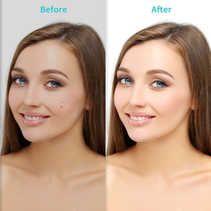 Xpreen XPRE061 Professional Dark Spot Remover Freckle Tattoo Chargeable Wart Mole Remover, with LED Screen and Spotlight