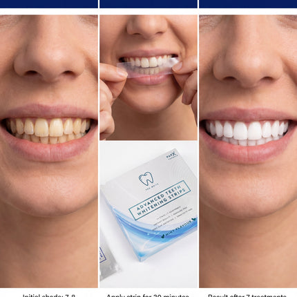 PAP-X™ Advanced Teeth Whitening Strips