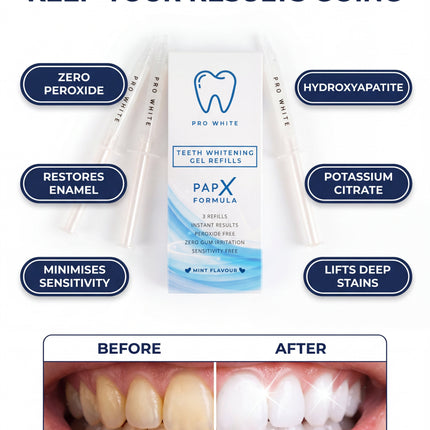 PAP-X™ Teeth Whitening Refills