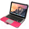 Notebook Leather Case with Snap Fastener for 15.4 inch MacBook Pro Retina