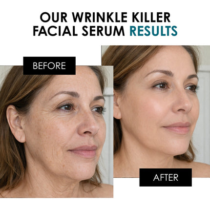 SC Wrinkle Killer Facial Serum 30ml