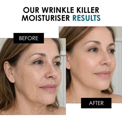 Wrinkle Killer Day Moisturiser 50ml