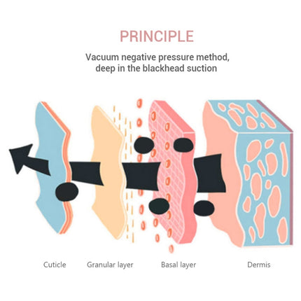 K-SKIN 3 Level Intensity Blackhead Removal Pore Cleaner Suction Rechargeable Black Spot Cleaner Facial Cleaning Machine