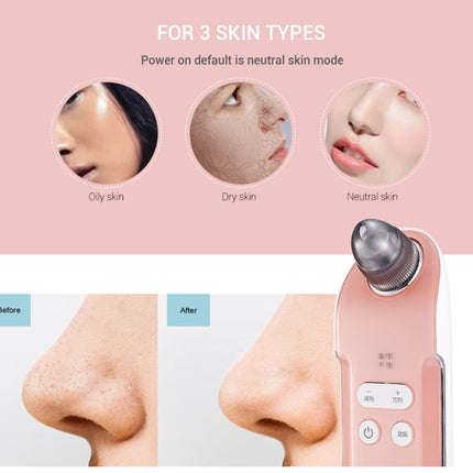 K-SKIN 3 Level Intensity Blackhead Removal Pore Cleaner Suction Rechargeable Black Spot Cleaner Facial Cleaning Machine