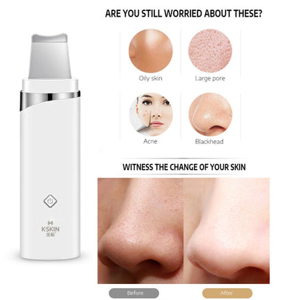 K-SKIN KD-8023Ultrasonic Blackhead Acne Removal Pore Cleaner Facial Skin Care Scrubber Exfoliating Pore Cleaner, KD-8023