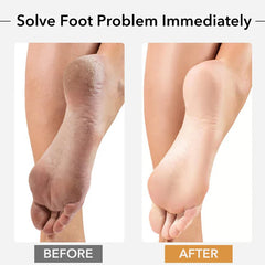 1PCS Professional Pedicure Rasp Tool for Dead Skin Crack Heels Beech Wood Foot File Rasp Callus Remover Foot Scrubber