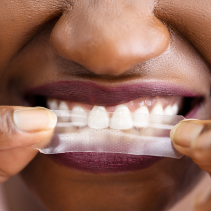 All Rounder Whitening Set - PAP-X™ Advanced Teeth Whitening Strips & Pen