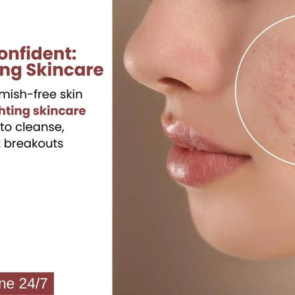 Ammuri Skincare Pigmentation Treatment Skincare Package