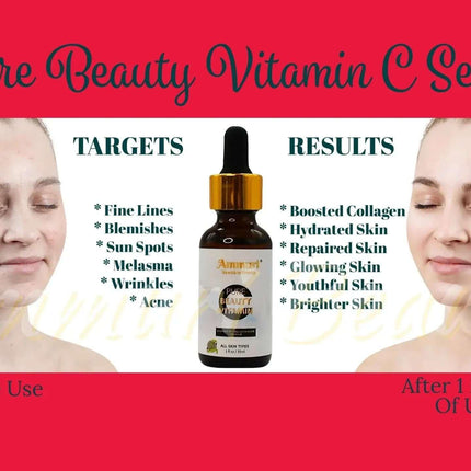 Ammuri Vitamin C Brightening Serum – Anti-Aging Dark Spot Treatment 30ml