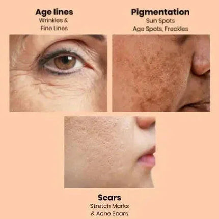 Apple Stem Cell Age Reverse Cream for Wrinkles & Skin Renewal | Ammuri