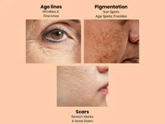 Ammuri Retinol Apple Stem Cell Age Reverse Cream