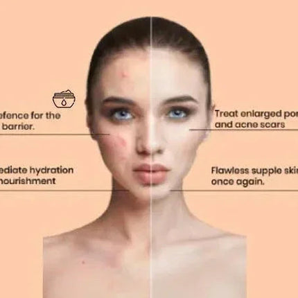 Apple Stem Cell Age Reverse Cream for Wrinkles & Skin Renewal | Ammuri
