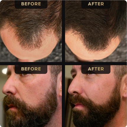 Baldr's Beard Pen + Hair Concealer Bundle