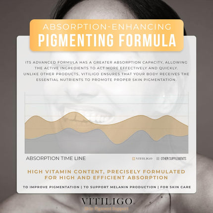 Dermawonder Vitiligo Capsules 60 Count | Effective Pigmentation Support & White Spot Reduction
