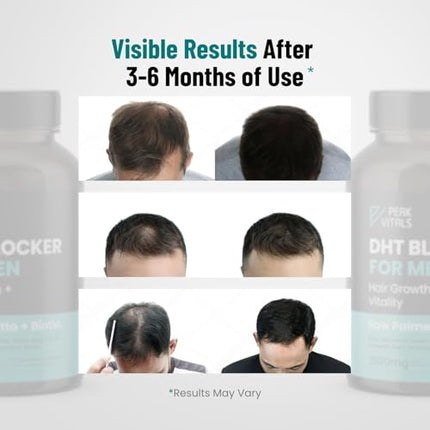 DHT Blocker for Men – Potent Hair Growth Formula | Saw Palmetto, Biotin, Pumpkin Seed | USA Made | 90 Capsules