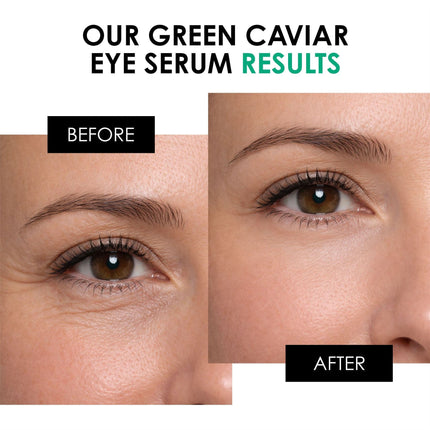 Green Caviar Eye Serum 15ml