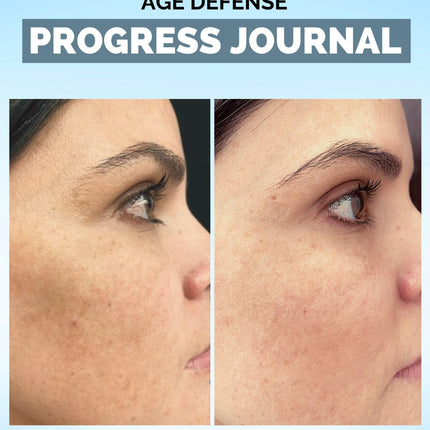Inner Glow Age Defense Vitamins – Dermatologist & Plastic Surgeon Developed Antioxidant Formula for Photoaging and Melasma – Vegan, Gluten-Free – 60 Capsules