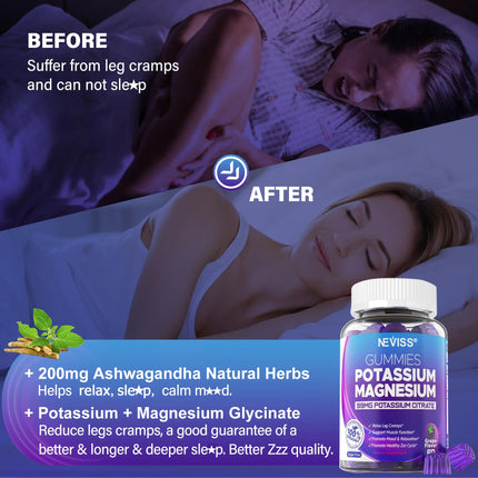 Potassium Magnesium Gummies - Ashwagandha 200mg, Mg Glycinate, B6 & B12 | Sugar-Free 2-Pack